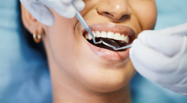 Best Dental Abscess Treatment in Box Elder, SD