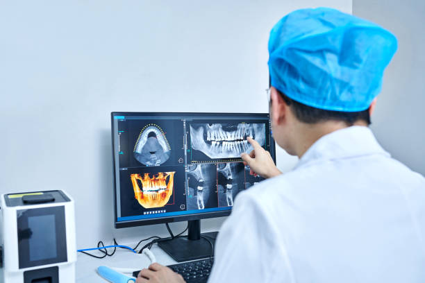 Best Knocked-Out Tooth (Avulsed Tooth) Treatment in Box Elder, SD